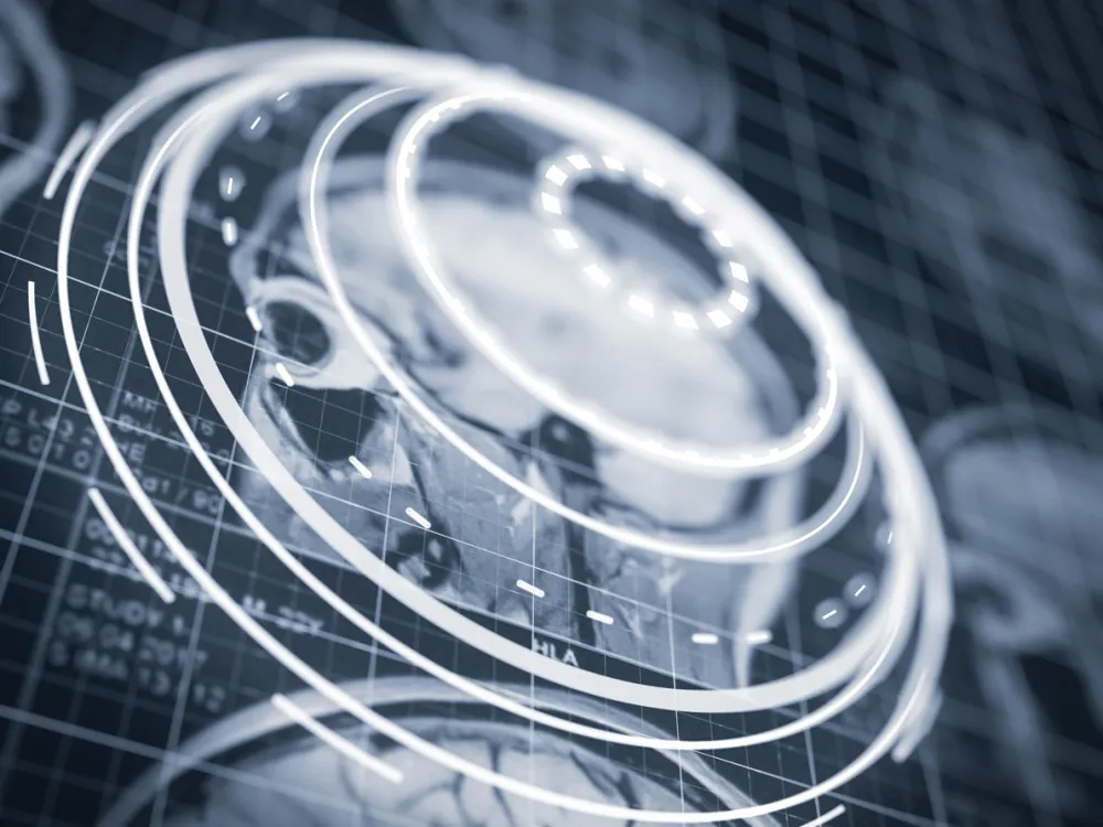 ARTICLE PROGRESS OF QUANTITATIVE MRI