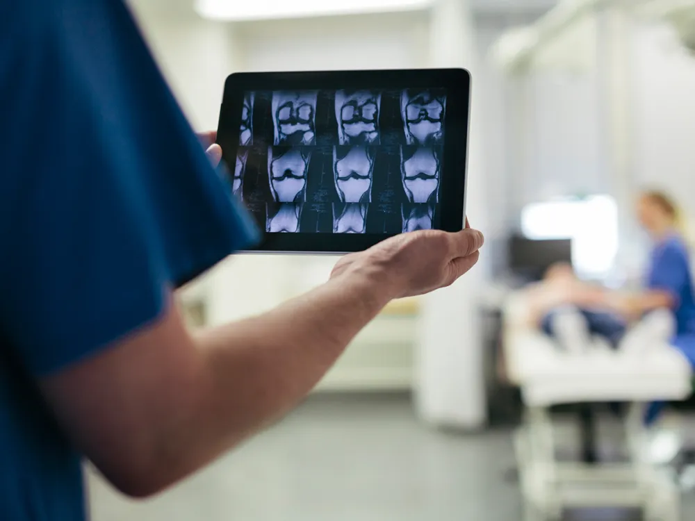 ARTICLE LEARN MORE ABOUT THE HISTORY OF MRI
