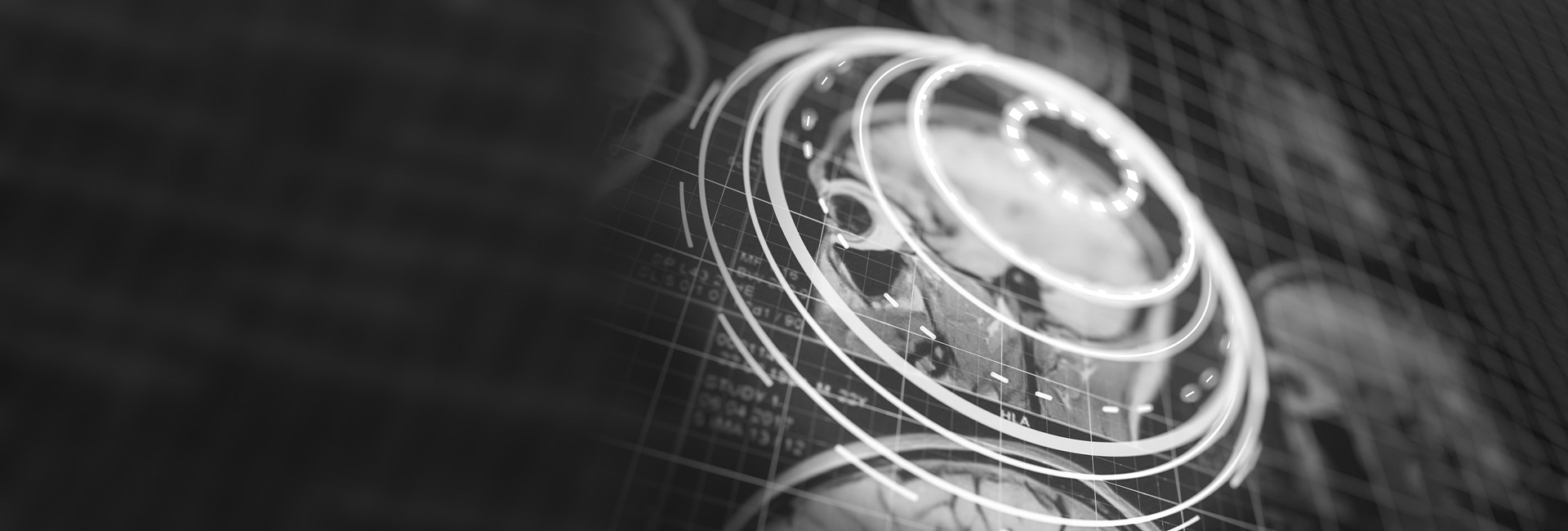 The progress of quantitative MRI towards biomarkers