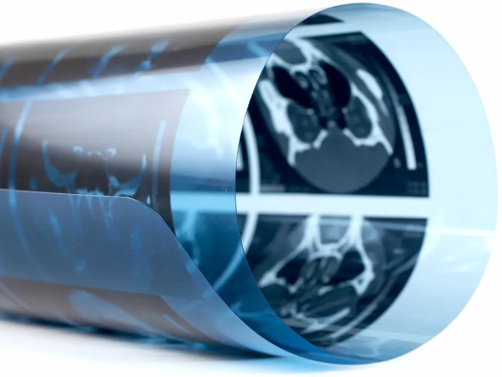 A brief history of MRI A brief history of MRI
